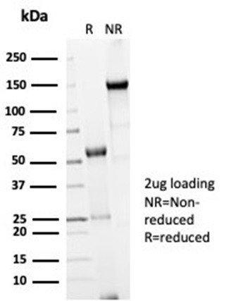 Cdc20 (Cell Division Cycle Protein 20) Antibody in SDS-PAGE (SDS-PAGE)