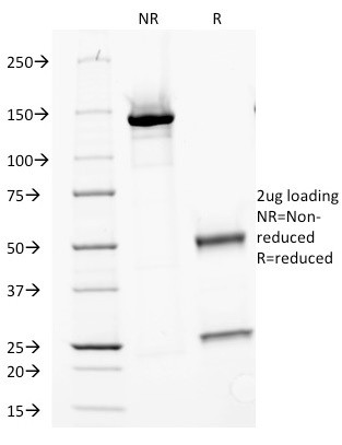 Major Vault Protein (MVP) Antibody in SDS-PAGE (SDS-PAGE)