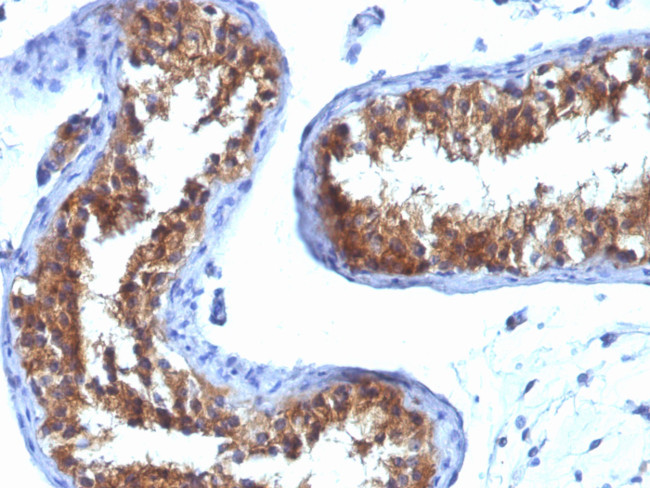 Major Vault Protein (MVP) Antibody in Immunohistochemistry (Paraffin) (IHC (P))