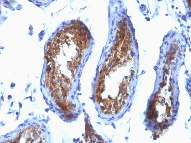 Major Vault Protein (MVP) Antibody in Immunohistochemistry (Paraffin) (IHC (P))