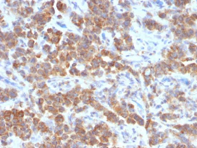 TNFS15/VEGI (Vascular Endothelial Growth Inhibitor) Antibody in Immunohistochemistry (Paraffin) (IHC (P))