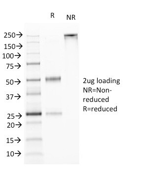 TNFS15/VEGI (Vascular Endothelial Growth Inhibitor) Antibody in SDS-PAGE (SDS-PAGE)