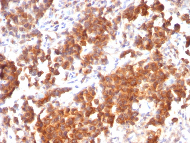 TNFS15/VEGI (Vascular Endothelial Growth Inhibitor) Antibody in Immunohistochemistry (Paraffin) (IHC (P))