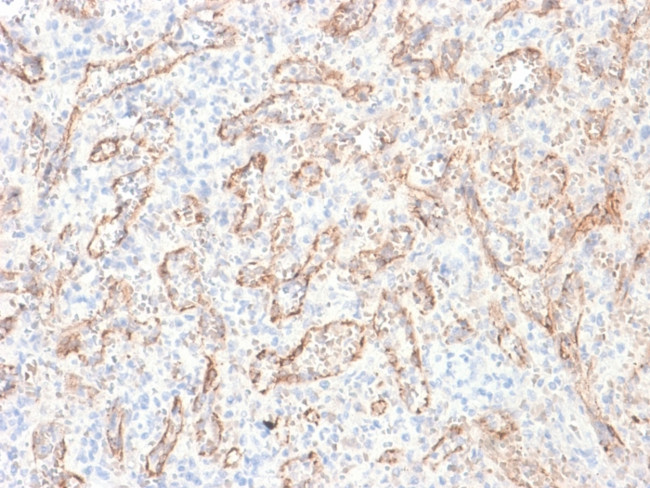 TNFS15/VEGI (Vascular Endothelial Growth Inhibitor) Antibody in Immunohistochemistry (Paraffin) (IHC (P))