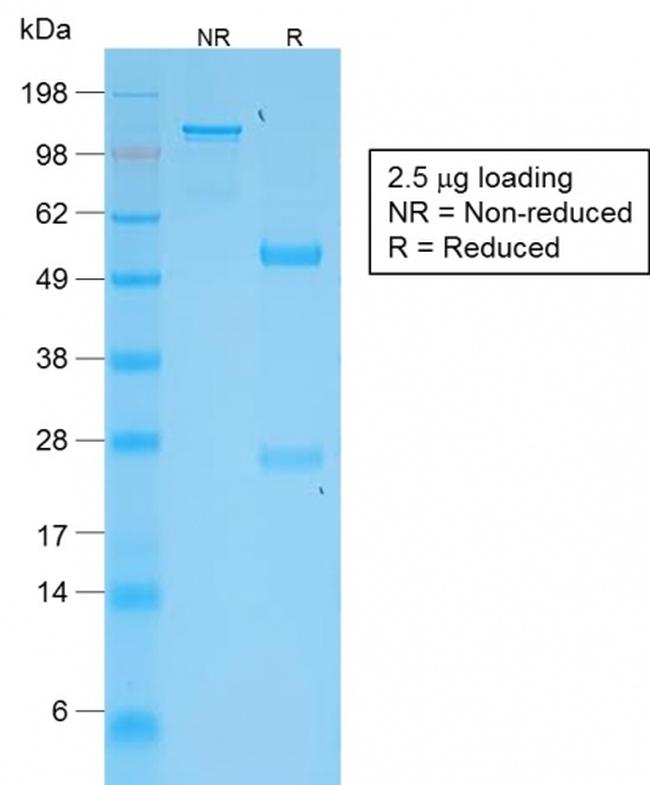 TNFS15/VEGI (Vascular Endothelial Growth Inhibitor) Antibody in SDS-PAGE (SDS-PAGE)