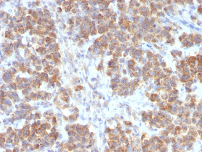 TNFS15/VEGI (Vascular Endothelial Growth Inhibitor) Antibody in Immunohistochemistry (Paraffin) (IHC (P))