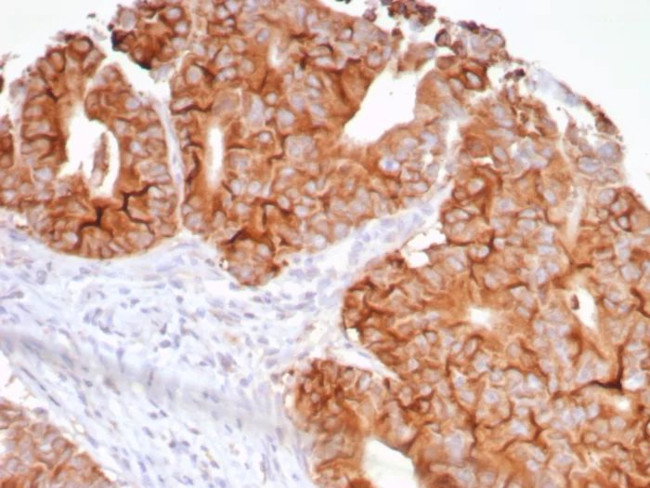 TNFS15/VEGI (Vascular Endothelial Growth Inhibitor) Antibody in Immunohistochemistry (Paraffin) (IHC (P))