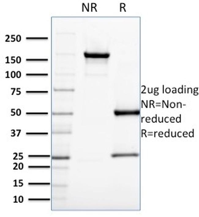 Cell Division Cycle 34 homolog Antibody in SDS-PAGE (SDS-PAGE)