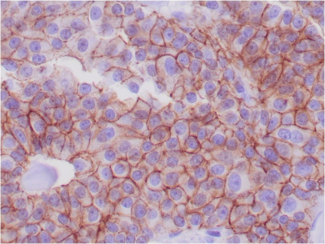 E-Cadherin (CDH1)/CD324 (Intercellular Junction Marker) Antibody in Immunohistochemistry (Paraffin) (IHC (P))