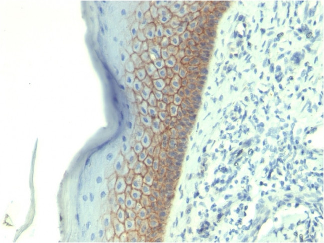 E-Cadherin (CDH1)/CD324 (Intercellular Junction Marker) Antibody in Immunohistochemistry (Paraffin) (IHC (P))