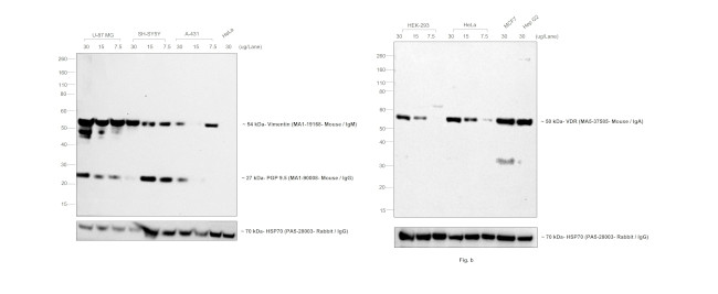 Mouse IgG, IgM, IgA (H+L) Secondary Antibody in Western Blot (WB)