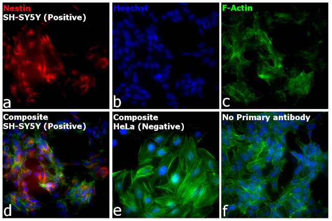 Mouse IgG (H+L) Cross-Adsorbed Secondary Antibody in Immunocytochemistry (ICC/IF)