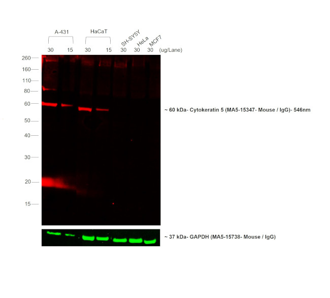 Mouse IgG (H+L) Cross-Adsorbed Secondary Antibody in Western Blot (WB)