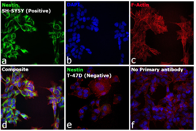 Mouse IgG (H+L) Cross-Adsorbed Secondary Antibody in Immunocytochemistry (ICC/IF)