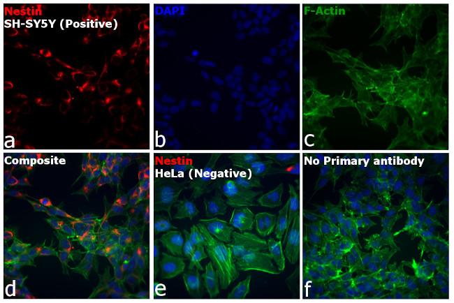 Mouse IgG (H+L) Cross-Adsorbed Secondary Antibody in Immunocytochemistry (ICC/IF)