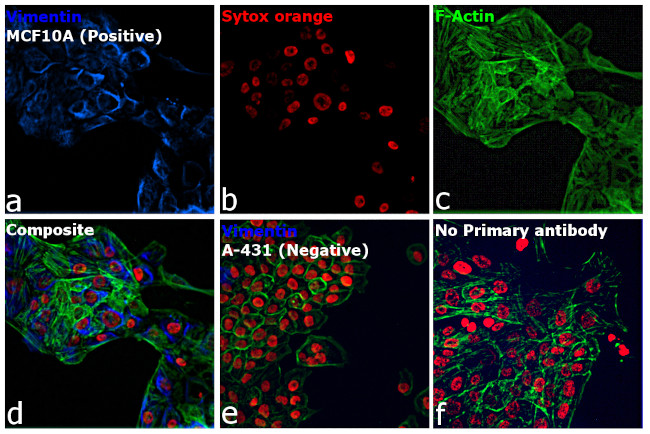 Rabbit IgG (H+L) Cross-Adsorbed Secondary Antibody in Immunocytochemistry (ICC/IF)