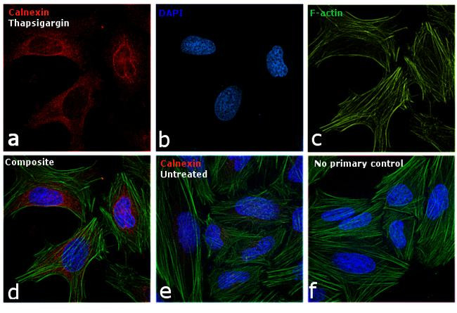 Mouse IgG (H+L) Cross-Adsorbed Secondary Antibody in Immunocytochemistry (ICC/IF)