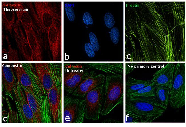 Mouse IgG (H+L) Cross-Adsorbed Secondary Antibody in Immunocytochemistry (ICC/IF)