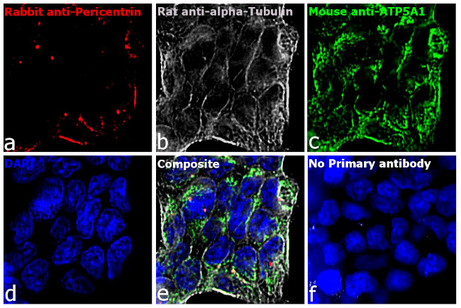 Rabbit IgG (H+L) Cross-Adsorbed Secondary Antibody in Immunocytochemistry (ICC/IF)