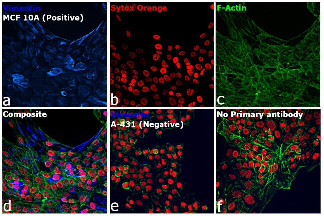 Rabbit IgG (H+L) Cross-Adsorbed Secondary Antibody in Immunocytochemistry (ICC/IF)