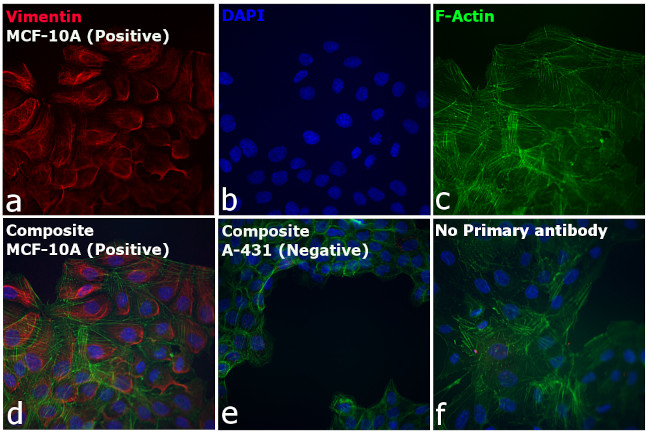 Rabbit IgG (H+L) Cross-Adsorbed Secondary Antibody in Immunocytochemistry (ICC/IF)