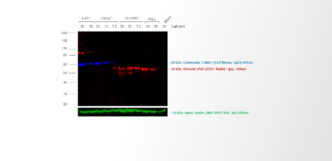 Rabbit IgG (H+L) Cross-Adsorbed Secondary Antibody in Western Blot (WB)