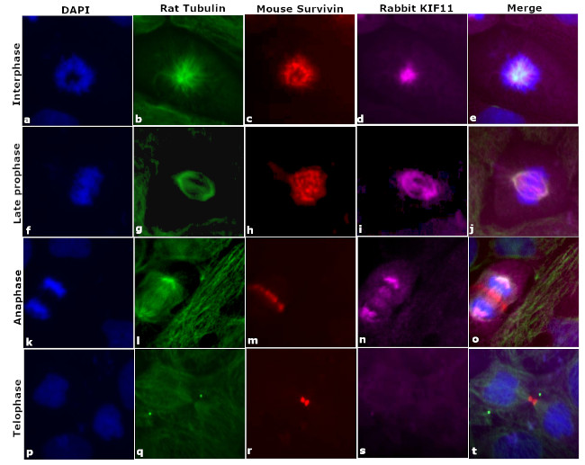 Rat IgG (H+L) Cross-Adsorbed Secondary Antibody in Immunocytochemistry (ICC/IF)