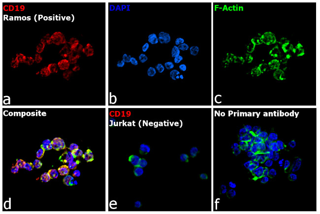 Rat IgG (H+L) Cross-Adsorbed Secondary Antibody in Immunocytochemistry (ICC/IF)