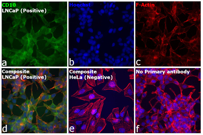 Goat IgG (H+L) Cross-Adsorbed Secondary Antibody in Immunocytochemistry (ICC/IF)