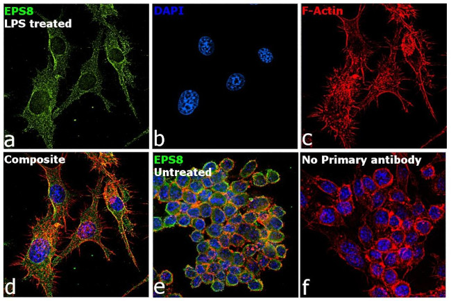 Goat IgG (H+L) Cross-Adsorbed Secondary Antibody in Immunocytochemistry (ICC/IF)