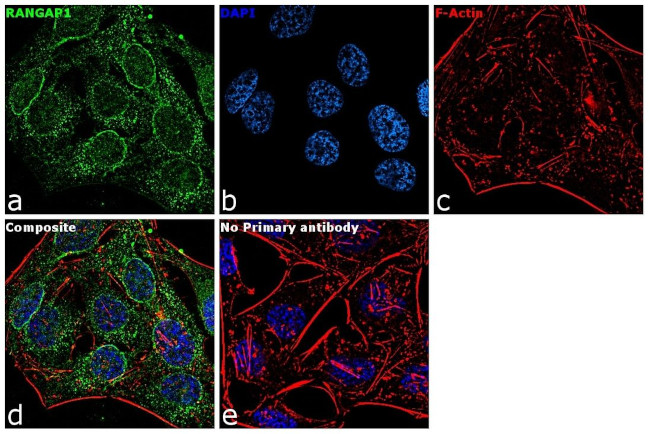 Goat IgG (H+L) Cross-Adsorbed Secondary Antibody in Immunocytochemistry (ICC/IF)