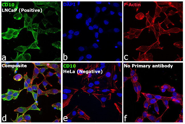 Goat IgG (H+L) Cross-Adsorbed Secondary Antibody in Immunocytochemistry (ICC/IF)