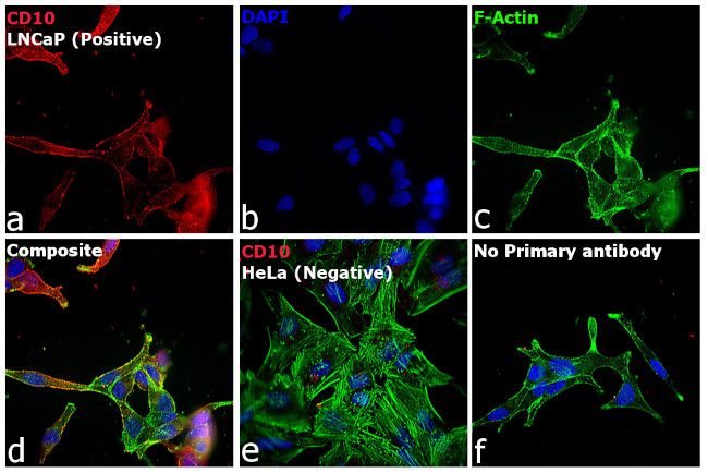 Goat IgG (H+L) Cross-Adsorbed Secondary Antibody in Immunocytochemistry (ICC/IF)