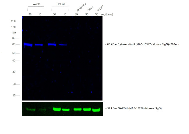 Mouse IgG (H+L) Cross-Adsorbed Secondary Antibody in Western Blot (WB)