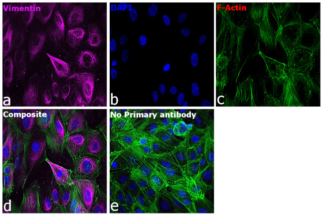 Mouse IgG (H+L) Cross-Adsorbed Secondary Antibody in Immunocytochemistry (ICC/IF)