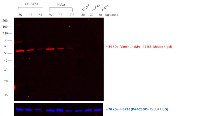 Mouse IgM (Heavy chain) Cross-Adsorbed Secondary Antibody in Western Blot (WB)