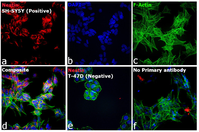 Mouse IgG (H+L) Cross-Adsorbed Secondary Antibody in Immunocytochemistry (ICC/IF)