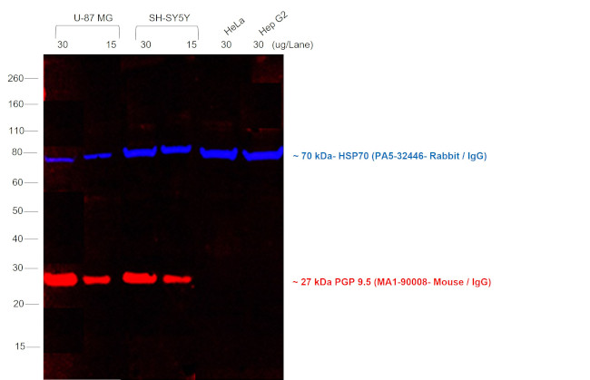 Mouse IgG (H+L) Cross-Adsorbed Secondary Antibody in Western Blot (WB)