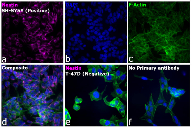 Mouse IgG (H+L) Cross-Adsorbed Secondary Antibody in Immunocytochemistry (ICC/IF)