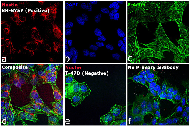 Mouse IgG (H+L) Highly Cross-Adsorbed Secondary Antibody in Immunocytochemistry (ICC/IF)