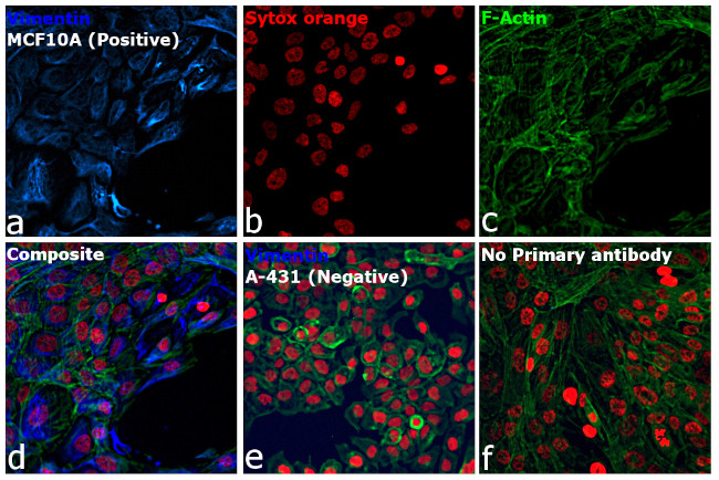 Rabbit IgG (H+L) Highly Cross-Adsorbed Secondary Antibody in Immunocytochemistry (ICC/IF)