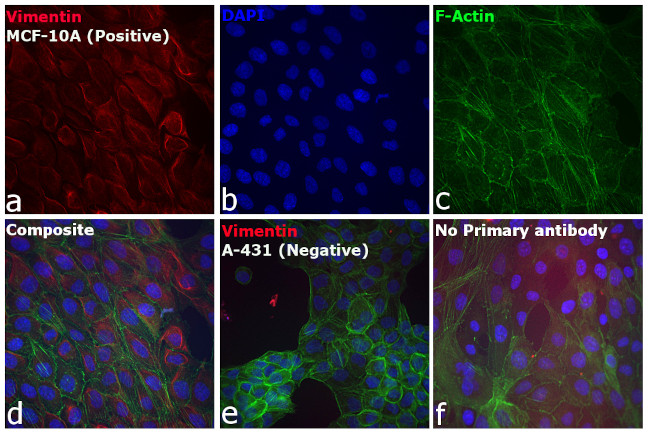 Rabbit IgG (H+L) Cross-Adsorbed Secondary Antibody in Immunocytochemistry (ICC/IF)