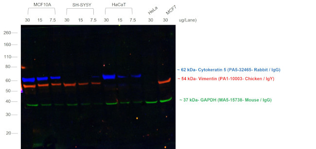 Rabbit IgG (H+L) Cross-Adsorbed Secondary Antibody in Western Blot (WB)