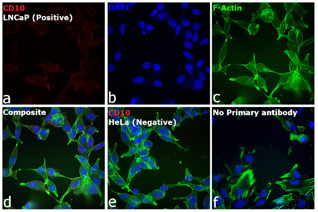 Goat IgG (H+L) Cross-Adsorbed Secondary Antibody in Immunocytochemistry (ICC/IF)