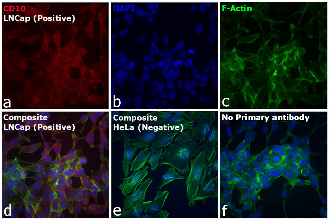 Goat IgG (H+L) Cross-Adsorbed Secondary Antibody in Immunocytochemistry (ICC/IF)