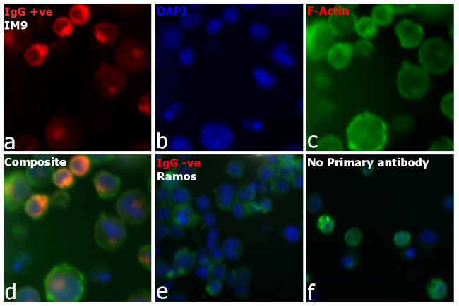 Human IgG (H+L) Cross-Adsorbed Secondary Antibody in Immunocytochemistry (ICC/IF)