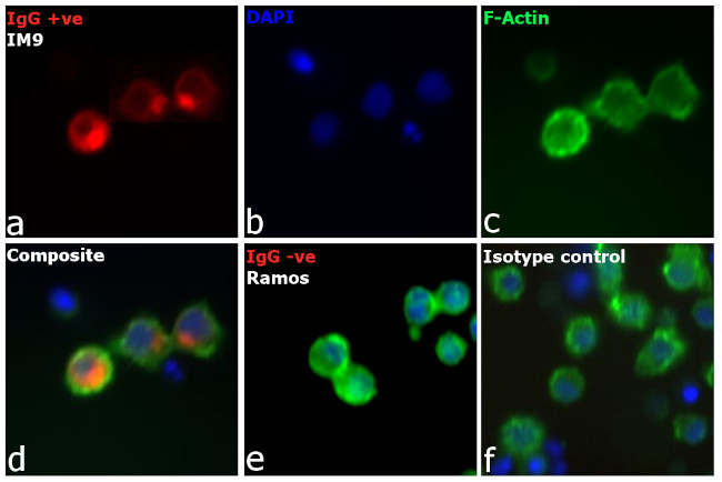 Human IgG (H+L) Cross-Adsorbed Secondary Antibody in Immunocytochemistry (ICC/IF)