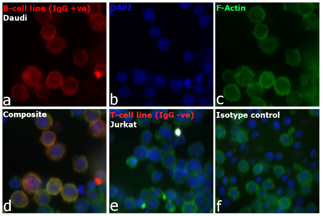 Human IgG (H+L) Cross-Adsorbed Secondary Antibody in Immunocytochemistry (ICC/IF)