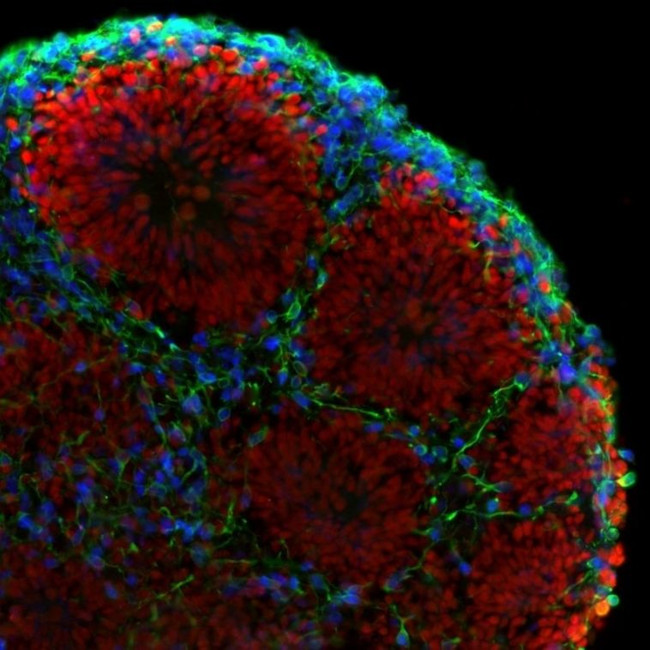 Rat IgG (H+L) Cross-Adsorbed Secondary Antibody in Immunohistochemistry (Frozen) (IHC (F))