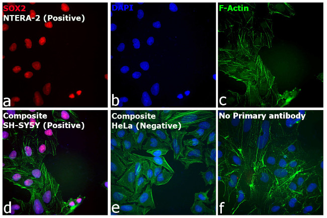 Rat IgG (H+L) Cross-Adsorbed Secondary Antibody in Immunocytochemistry (ICC/IF)